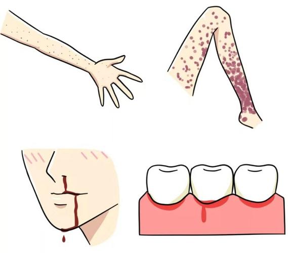血小板降低的防治方法有哪些,上门取货_123随叫随到