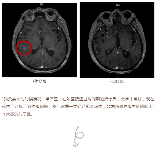 腹腔长40厘米长肿瘤,物流专线直达_123随叫随到